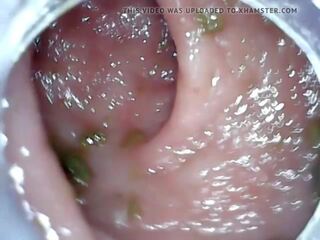 পায়ুপথ endoscope অংশ 1, বিনামূল্যে মলদ্বারে তরল ঢূকানো শাস্তি এইচ ডি বয়স্ক চলচ্চিত্র 04 | xhamster